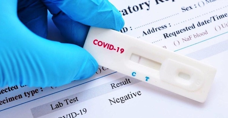 Bộ Y tế khẳng định đã có nhiều văn bản chỉ đạo về giá xét nghiệm nhanh kháng nguyên, Bộ dự kiến đề nghị đưa test xét nghiệm Covid-19 vào mặt hàng bình ổn giá, vì hiện nay mỗi nơi áp đặt một giá, khiến nhiều người băng khoăn.