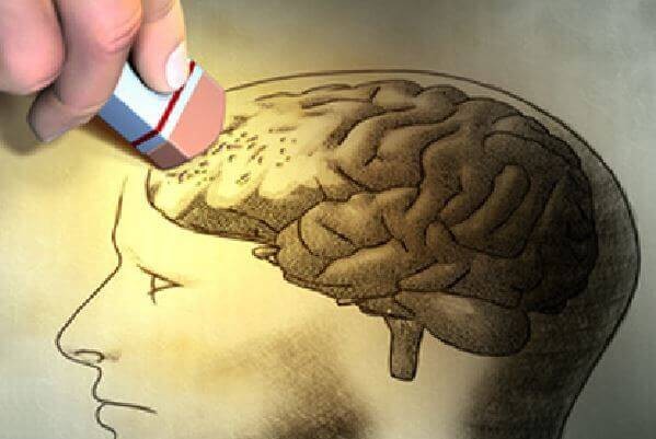 Alzheimer là một bệnh tăng triển của não bộ với sự đóng tụ protein bất thường trong não làm chết các tế bào não